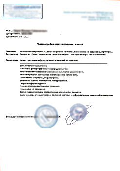 Купить справку о флюорографии в Москве.